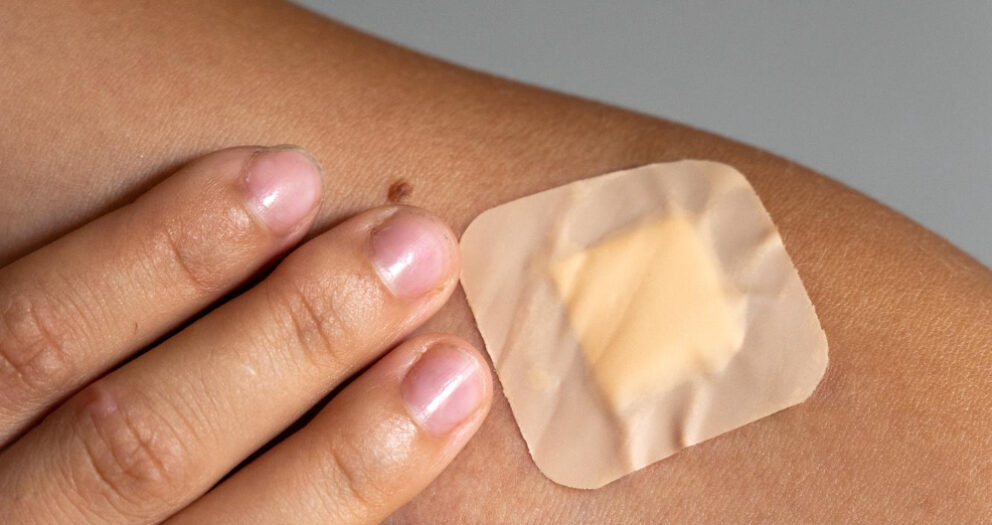 opatrunek hydrokoloidowy